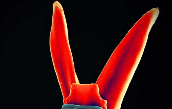 Picture Wednesday: Bunny nematoda and other colours | Day 249